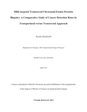 MRI-targeted Transrectal Ultrasound Fusion prostate biopsies: a comparative study of cancer detection rates in Transperineal versus Transrectal approach thumbnail