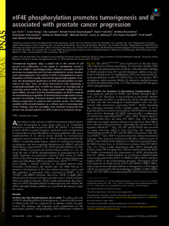 eIF4E phosphorylation promotes tumorigenesis and is associated with prostate cancer progression thumbnail