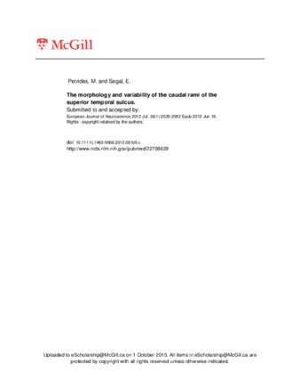 The morphology and variability of the caudal rami of the superior temporal sulcus thumbnail