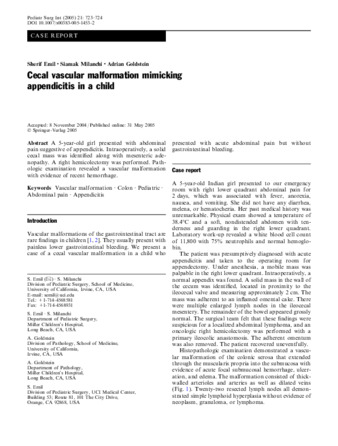 Cecal vascular malformation mimicking appendicitis in a child. thumbnail