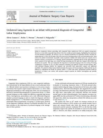 Unilateral Lung Agenesis in an infant with prenatal diagnosis of Congenital Lobar Emphysema thumbnail