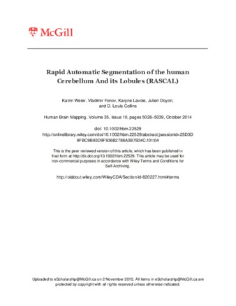 Rapid Automatic Segmentation of the human Cerebellum And its Lobules (RASCAL) thumbnail