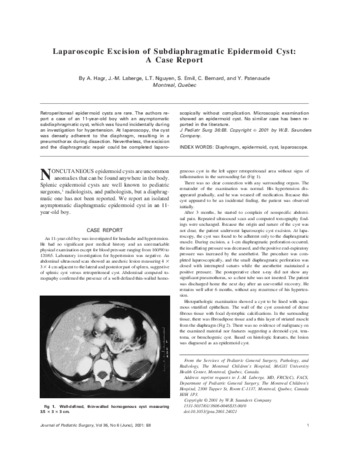 Laparoscopic Excision of Subdiaphragmatic Epidermoid Cyst: A Case Report thumbnail