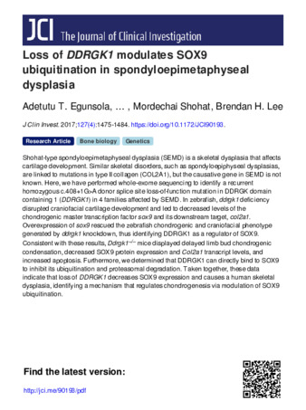 Loss of DDRGK1 modulates SOX9 ubiquitination in spondyloepimetaphyseal dysplasia thumbnail