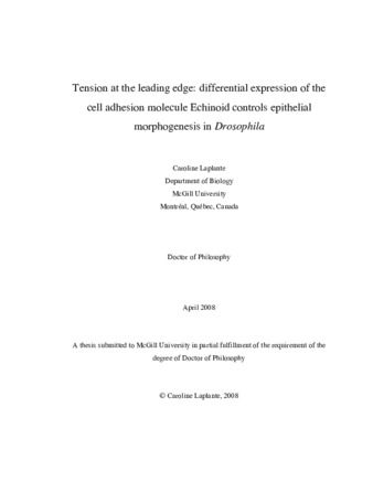 Tension at the leading edge: differential expression of the cell adhesion molecule Echinoid controls epithelial morphogenesis in «Drosophila» thumbnail