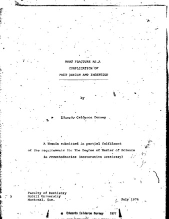 Root fracture as a complication of post design and insertion thumbnail