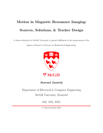 Motion in magnetic resonance imaging - sources, solutions, & tracker design thumbnail