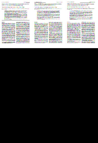 Effects of B-HT 920 on nigrostriatal and mesolimbic dopamine systems in normosensitive and supersensitive rats. thumbnail