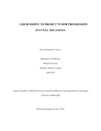 Liquid biopsy to predict tumor progression in uveal melanoma thumbnail