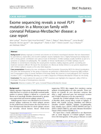 Exome sequencing reveals a novel PLP1 mutation in a Moroccan family with connatal Pelizaeus-Merzbacher disease: a case report thumbnail